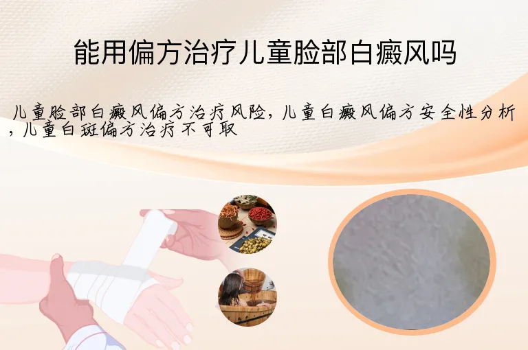能用偏方治疗儿童脸部白癜风吗
