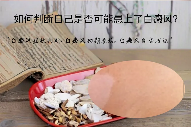 如何判断自己是否可能患上了白癜风？