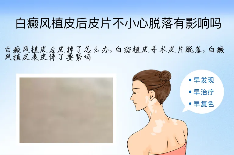 白癜风植皮后皮片不小心脱落有影响吗