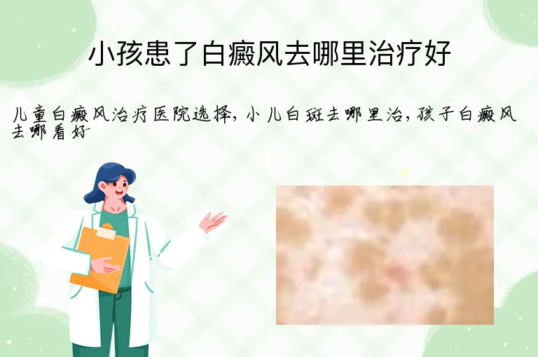小孩患了白癜风去哪里治疗好