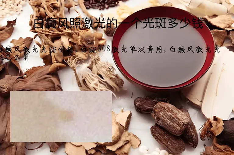 白癜风照激光的一个光斑多少钱