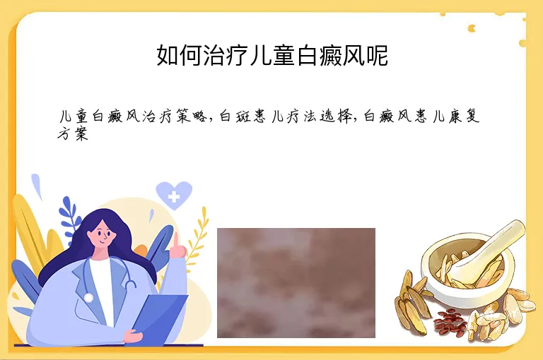 如何治疗儿童白癜风呢