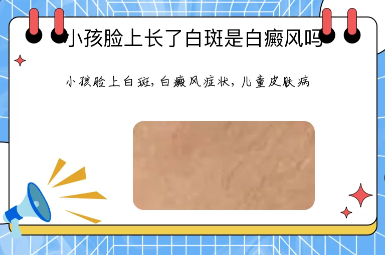小孩脸上长了白斑是白癜风吗