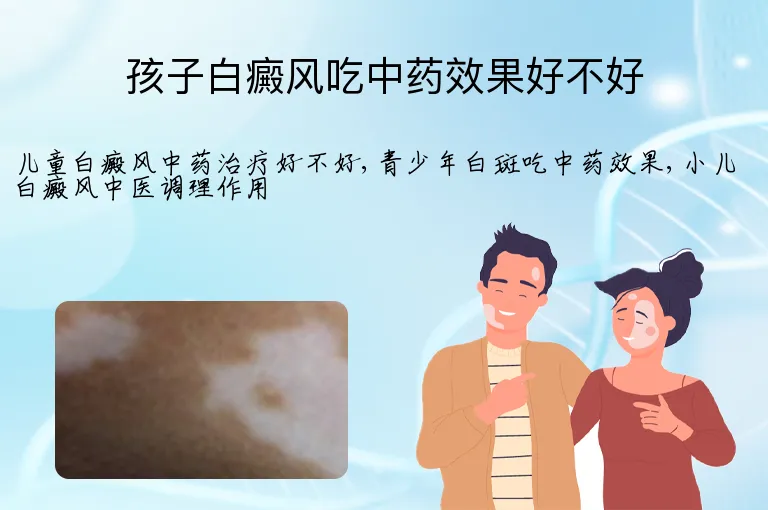孩子白癜风吃中药效果好不好