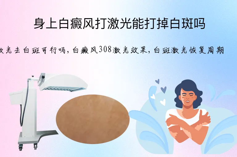 身上白癜风打激光能打掉白斑吗