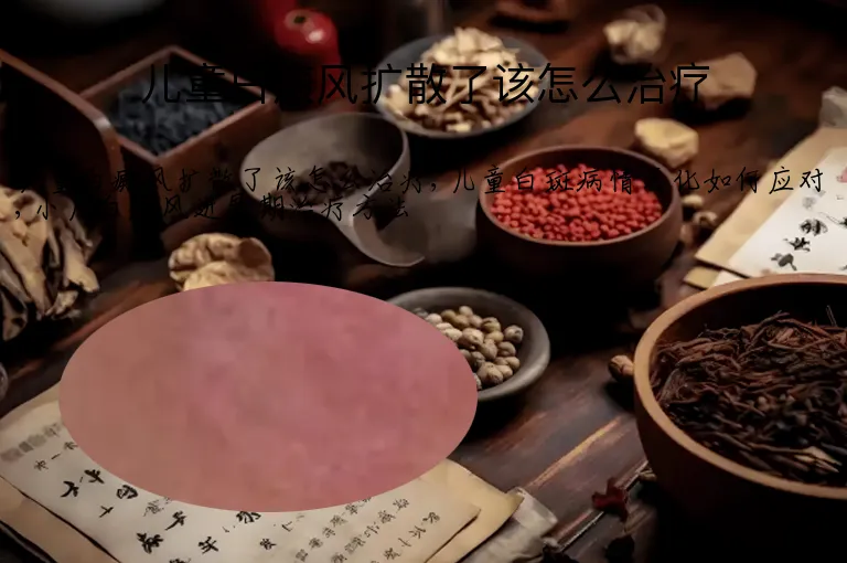 儿童白癜风扩散了该怎么治疗