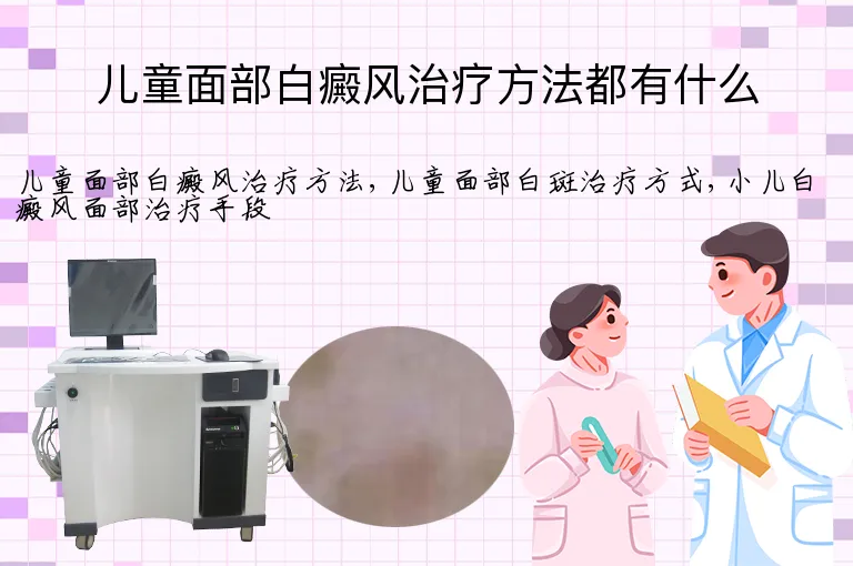 儿童面部白癜风治疗方法都有什么