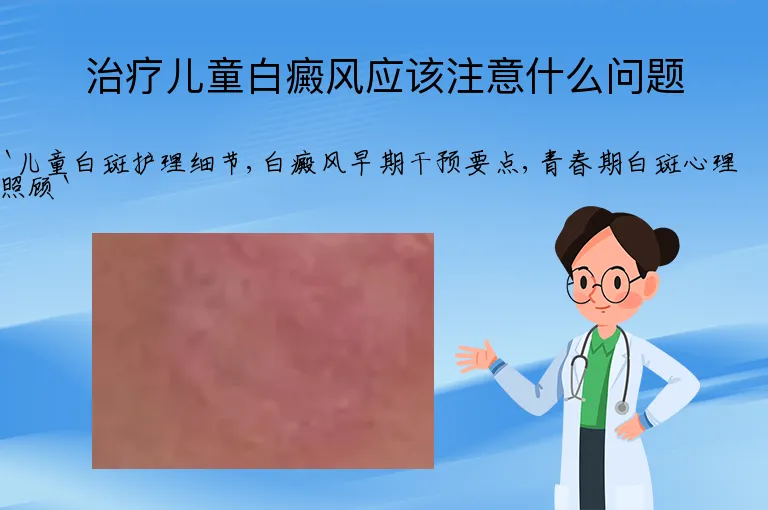 治疗儿童白癜风应该注意什么问题