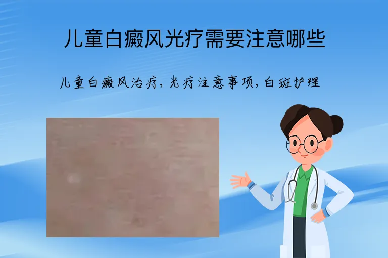儿童白癜风光疗需要注意哪些