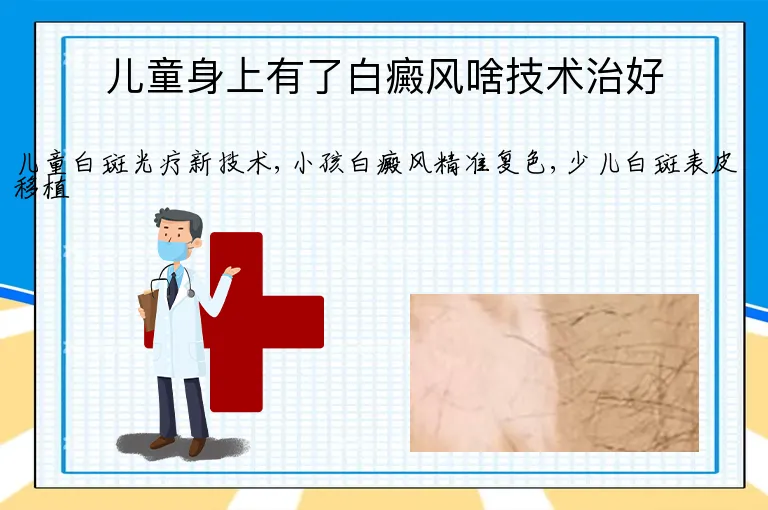 儿童身上有了白癜风啥技术治好