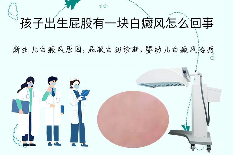 孩子出生屁股有一块白癜风怎么回事