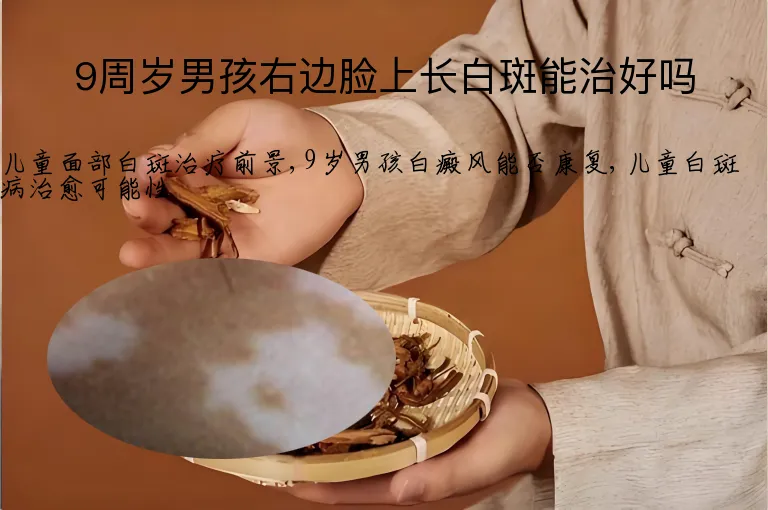 9周岁男孩右边脸上长白斑能治好吗