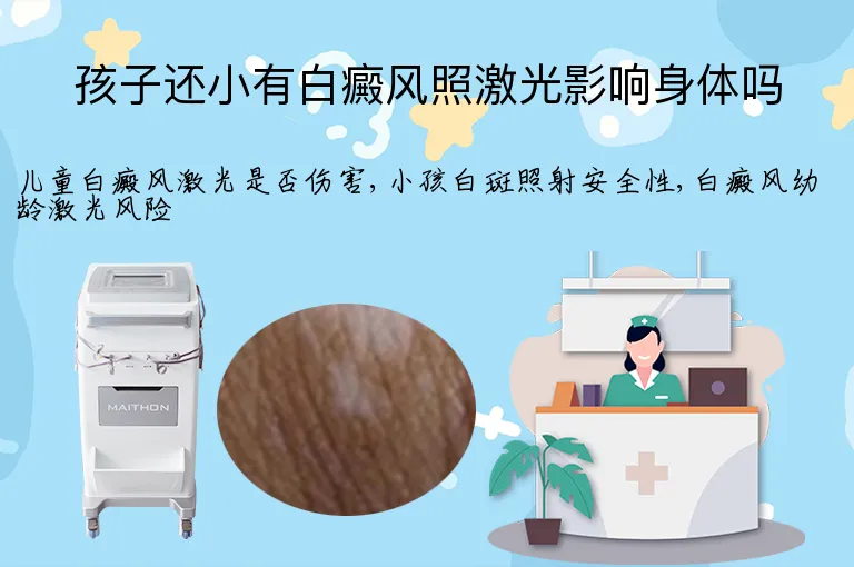 孩子还小有白癜风照激光影响身体吗