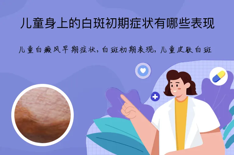 儿童身上的白斑初期症状有哪些表现