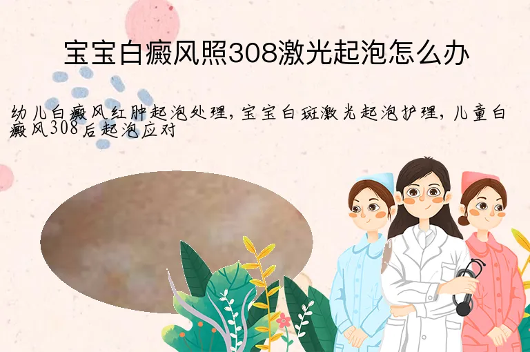 宝宝白癜风照308激光起泡怎么办