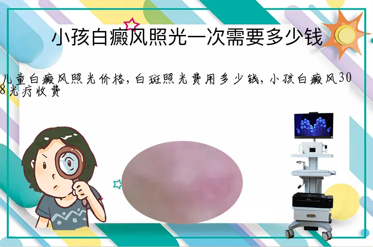 小孩白癜风照光一次需要多少钱