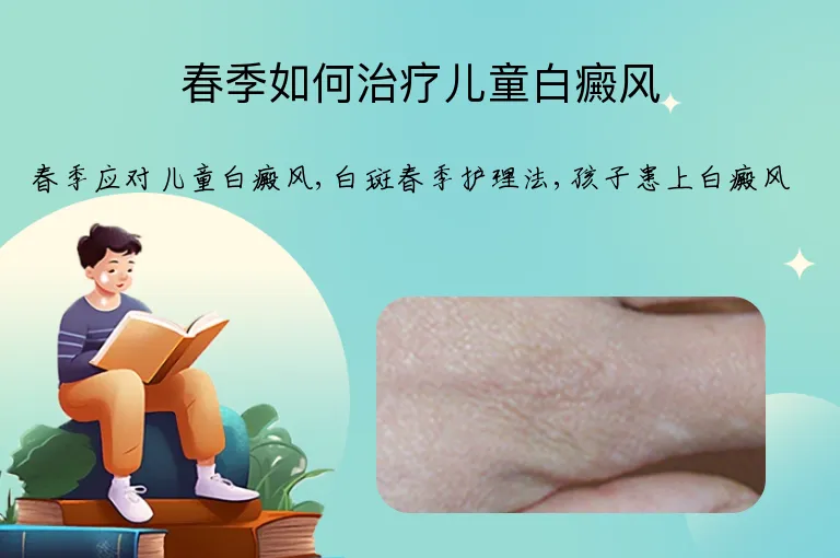 春季如何治疗儿童白癜风