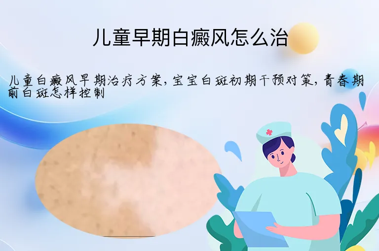 儿童早期白癜风怎么治