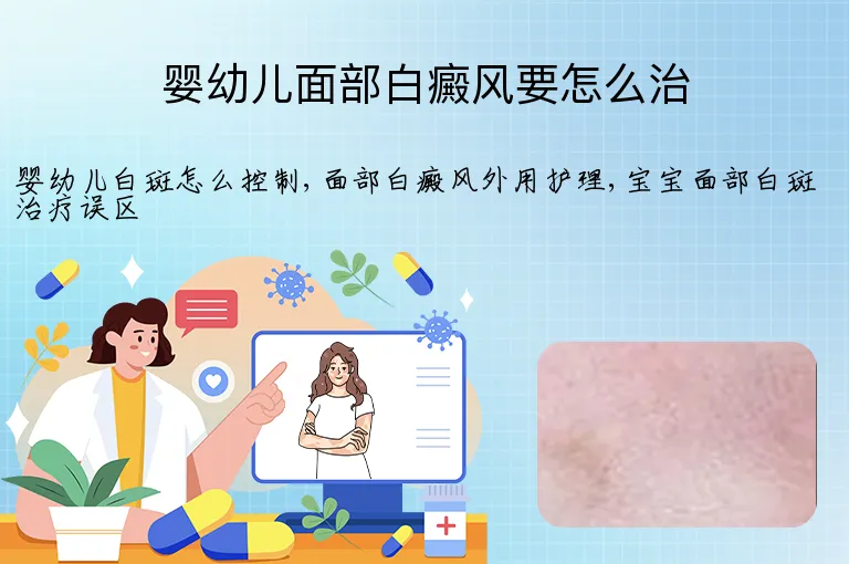 婴幼儿面部白癜风要怎么治