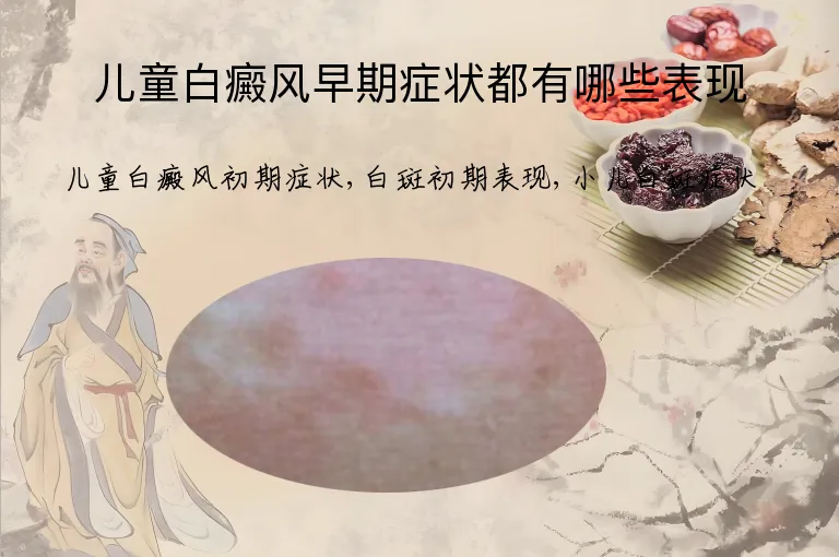 儿童白癜风早期症状都有哪些表现