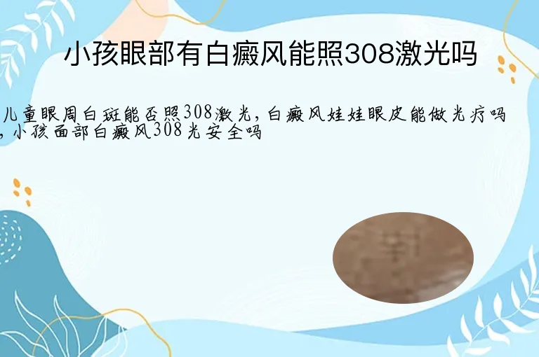 小孩眼部有白癜风能照308激光吗