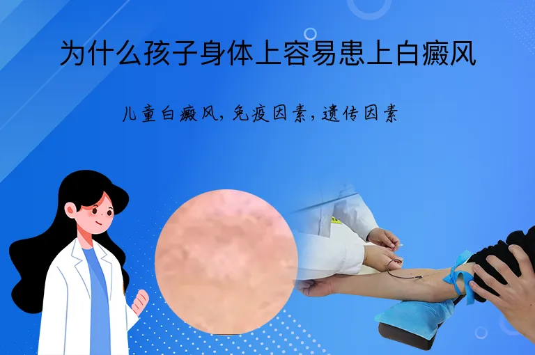 为什么孩子身体上容易患上白癜风