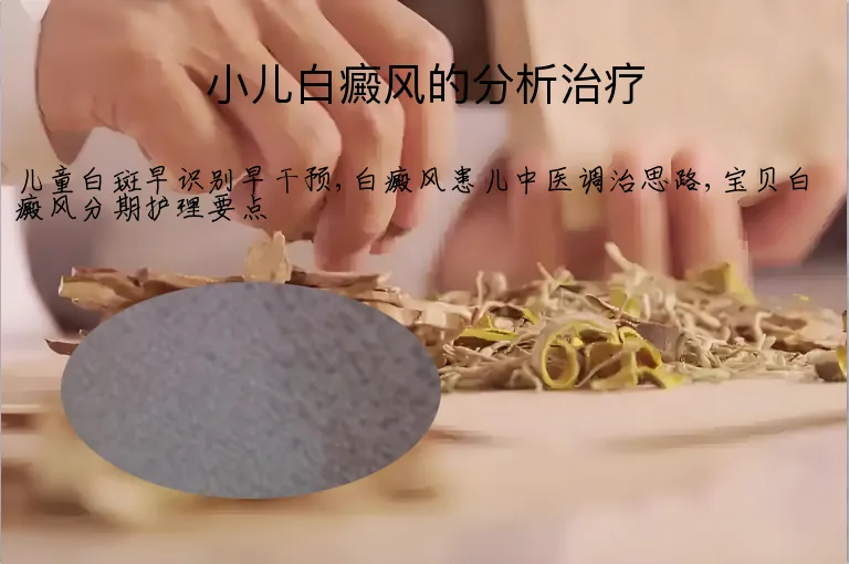 小儿白癜风的分析治疗