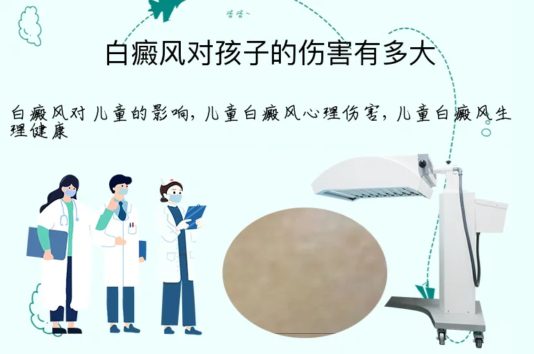 白癜风对孩子的伤害有多大