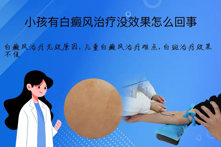 小孩有白癜风治疗没效果怎么回事