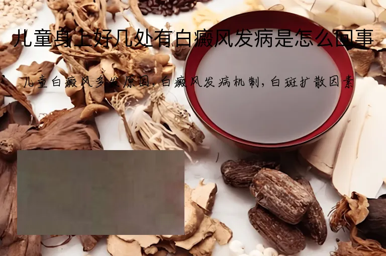 儿童身上好几处有白癜风发病是怎么回事