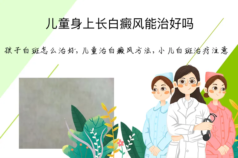 儿童身上长白癜风能治好吗