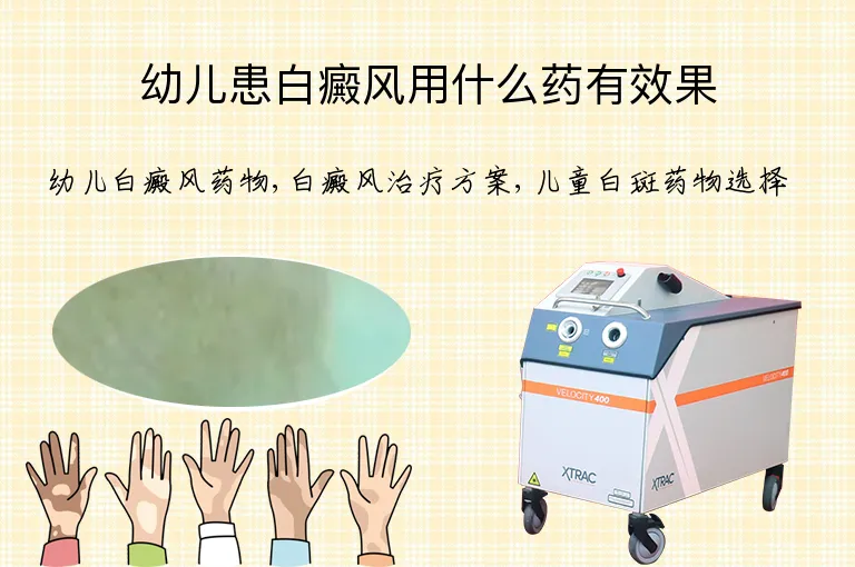 幼儿患白癜风用什么药有效果