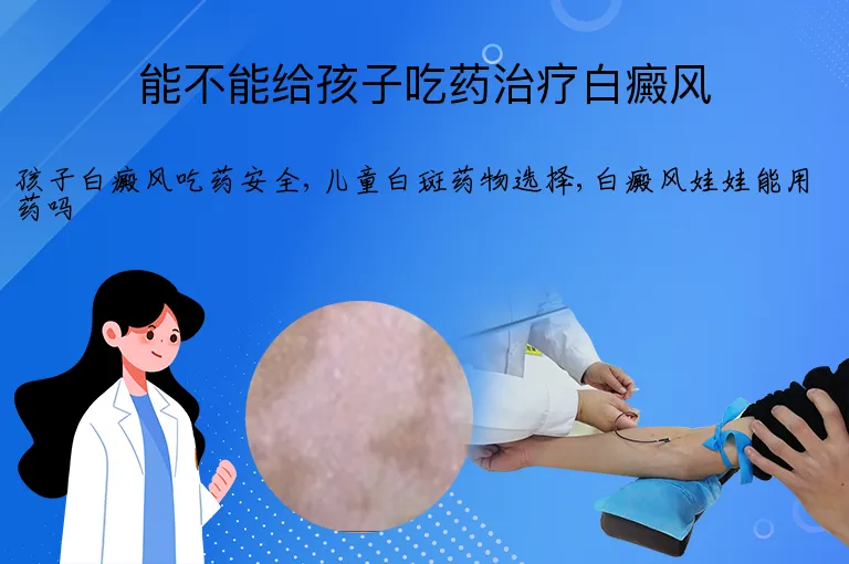 能不能给孩子吃药治疗白癜风