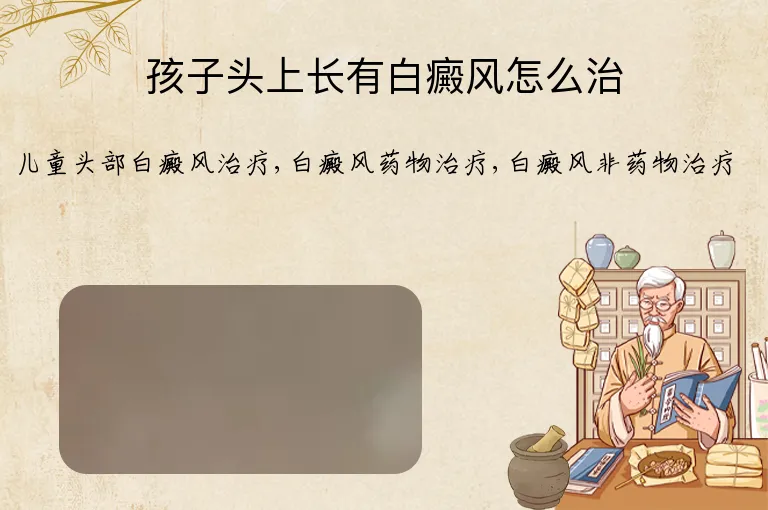 孩子头上长有白癜风怎么治