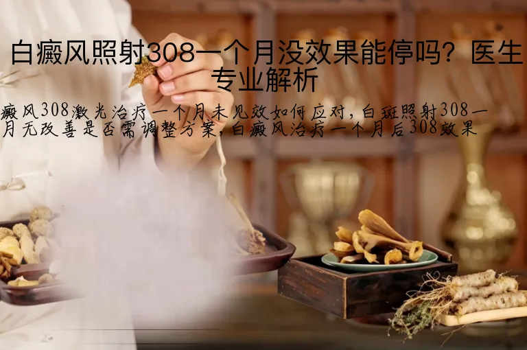 白癜风照射308一个月没效果能停吗？医生专业解析