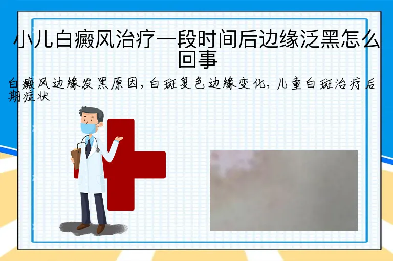 小儿白癜风治疗一段时间后边缘泛黑怎么回事