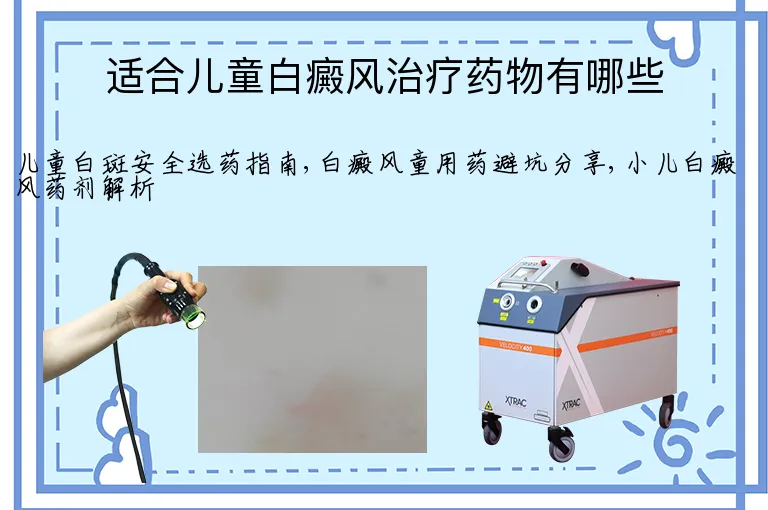 适合儿童白癜风治疗药物有哪些