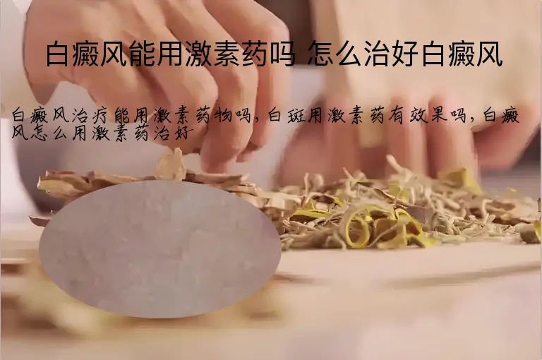 白癜风能用激素药吗 怎么治好白癜风