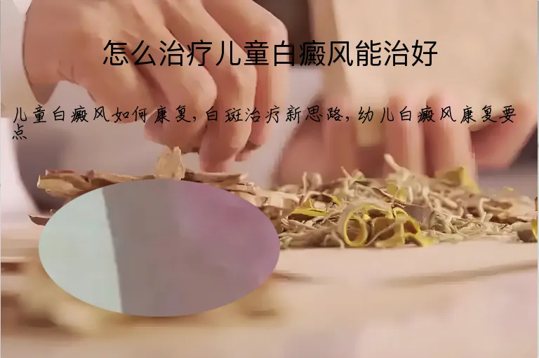 怎么治疗儿童白癜风能治好