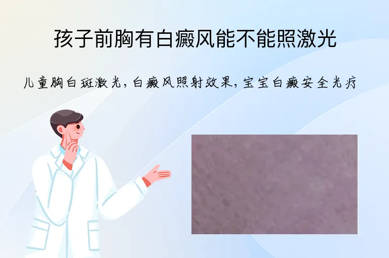 孩子前胸有白癜风能不能照激光