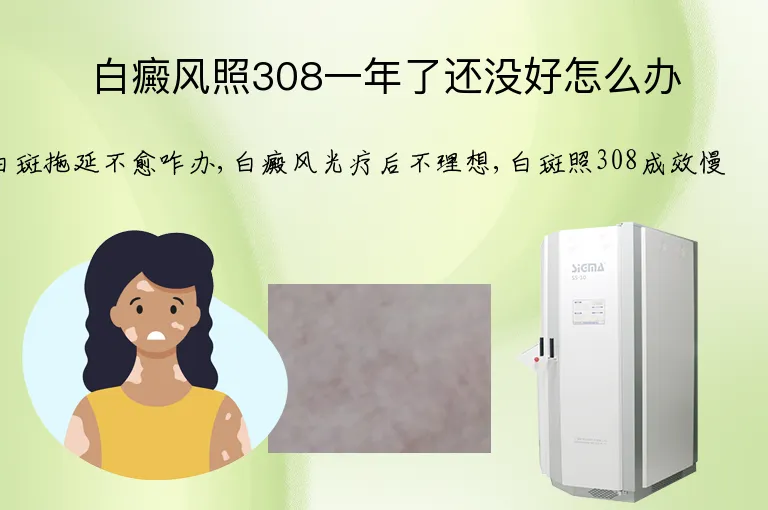 白癜风照308一年了还没好怎么办