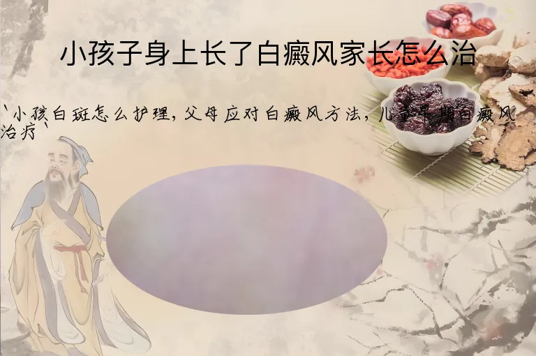 小孩子身上长了白癜风家长怎么治