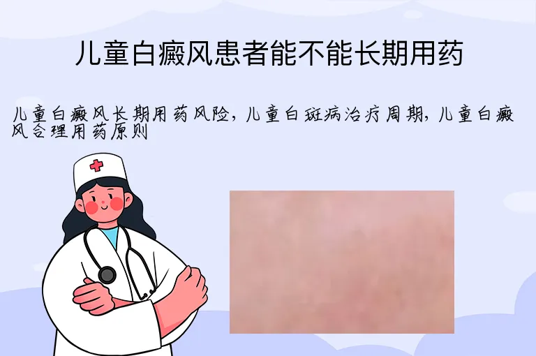 儿童白癜风患者能不能长期用药