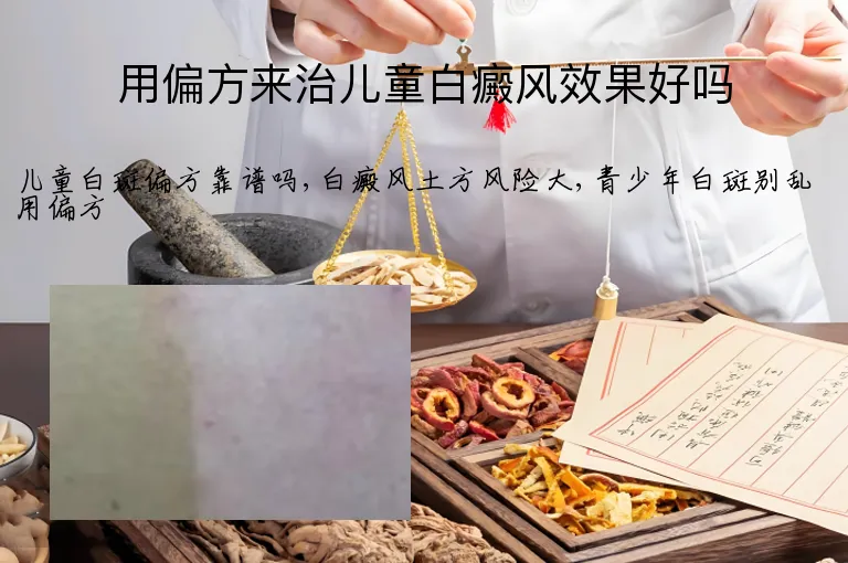用偏方来治儿童白癜风效果好吗