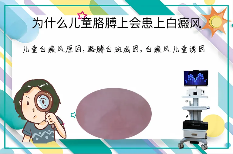 为什么儿童胳膊上会患上白癜风