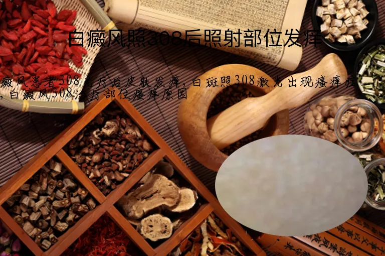 白癜风照308后照射部位发痒