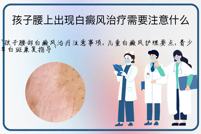 孩子腰上出现白癜风治疗需要注意什么