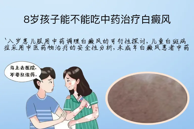 8岁孩子能不能吃中药治疗白癜风