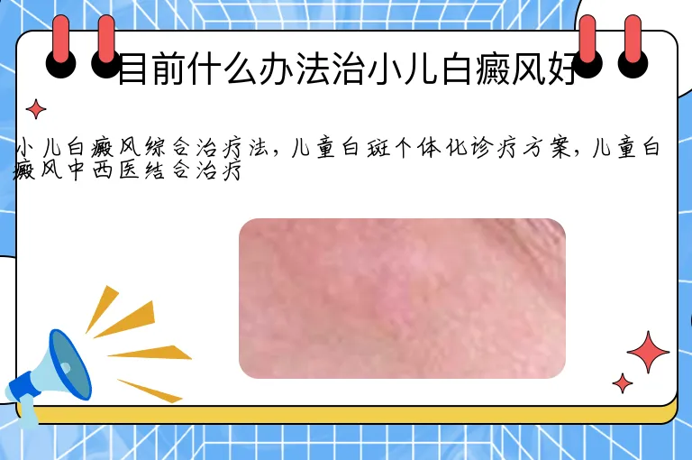 目前什么办法治小儿白癜风好
