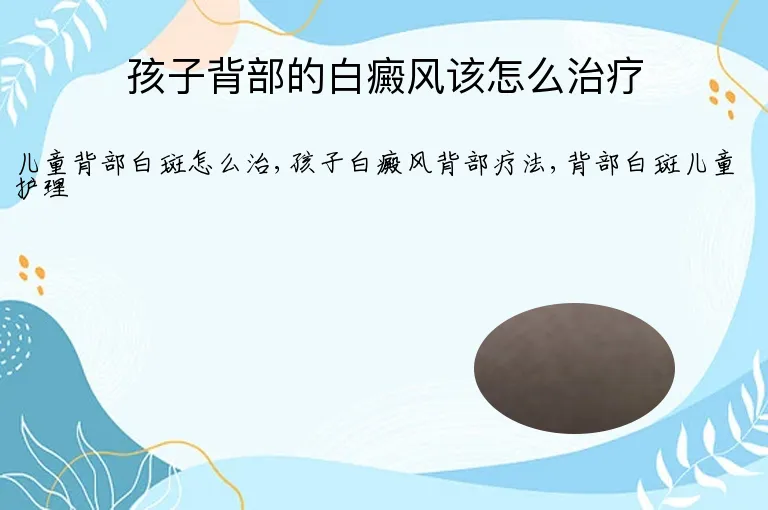 孩子背部的白癜风该怎么治疗